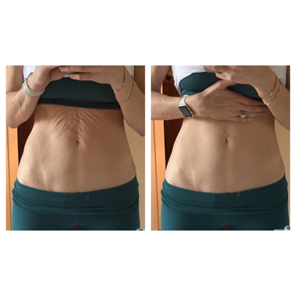 Cryo Firming Gold Gel